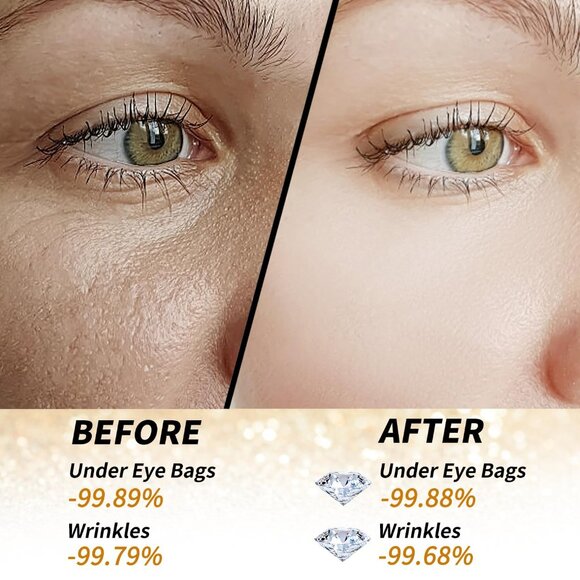 Golden Glow Under Eye Patches for Puffy Eyes - 60Pcs Eye Gels - Picture 5 of 7